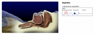 apnée sommeil